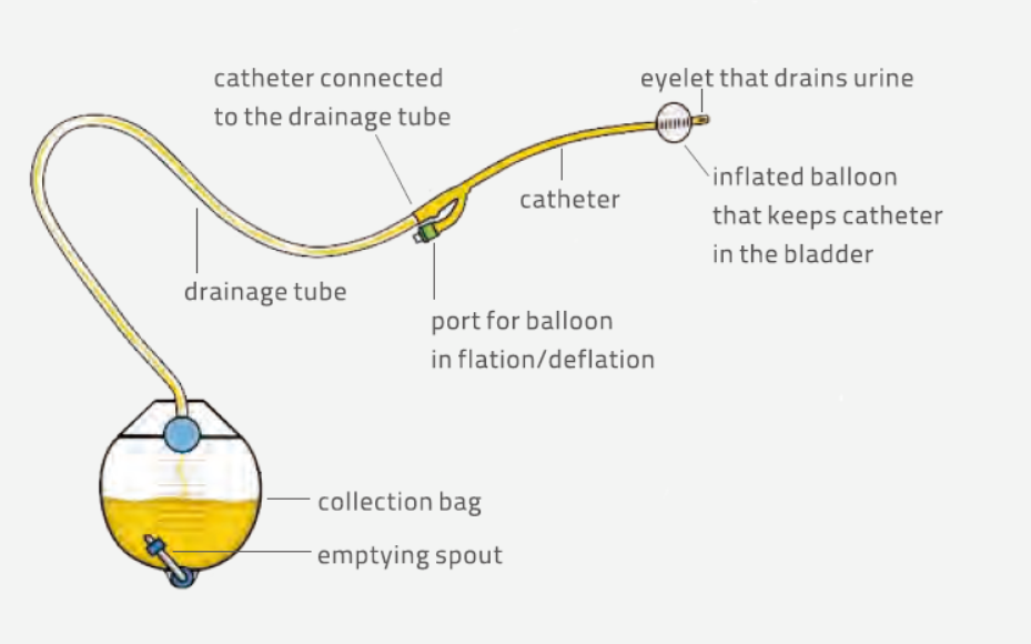 product-Urology-Usage-of-Foley-Catheter.